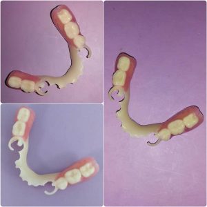 Beli vizil moj stomatolog zarkovo beograd