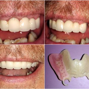 Beli vizil moj stomatolog zarkovo beograd