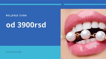 Beljenje zuba, moj stomatolog, zubar Zarkovo, Cerak, beograd