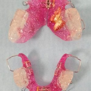 Mobilne proteze za decu, moj stomatolog zarkovo, beograd