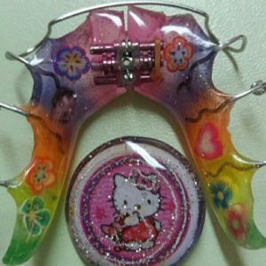 Mobilne proteze za decu, moj stomatolog zarkovo, beograd